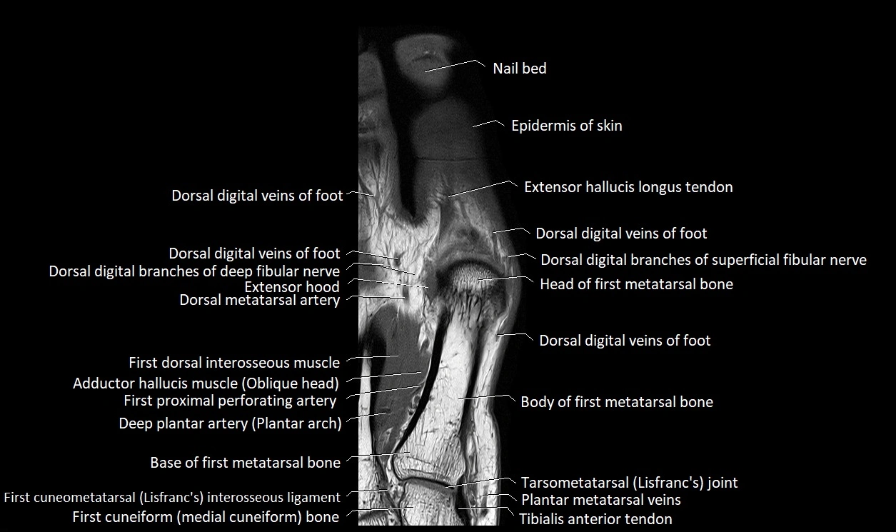 Great Toe micro anatomy MRI axial cross sectional 3T image 11.webp